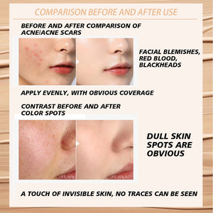 Visual guide showing color correction for dark circles and acne marks using Sweet Mint 3 Color Palette.
